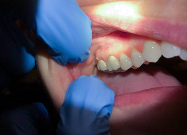 Best Weekend Emergency Dentist in Wyoming, PA